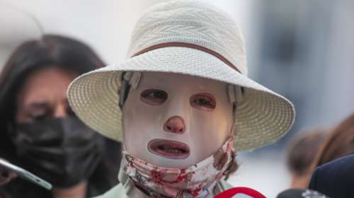 Επίθεση με βιτριόλι: Αύριο καταθέτουν οι γιατροί της Ιωάννας - &quot;Μόνο από τη γάμπα και κάτω δεν έχει καεί&quot;