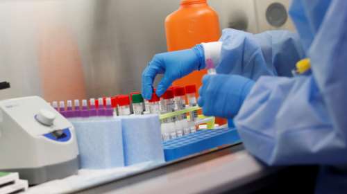 Νέα γενιά ανοσοθεραπείας για τον κορονοϊό με νανο-αντισώματα - ασπίδα για τον οργανισμό