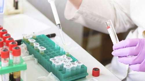 Διαψεύδει το Ινστιτούτο Παστέρ τις φήμες περί lock down: Λαμβάνουμε καθημερινά 1.000 δείγματα για έλεγχο