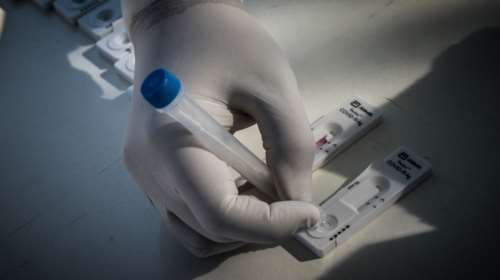 ΕΟΔΥ: Τα 169 σημεία όπου θα πραγματοποιούνται σήμερα δωρεάν rapid test