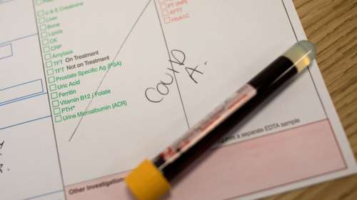 Νέο κρούσμα κορονοϊού στην Κρήτη - Θετικός 30χρονος Ρουμάνος