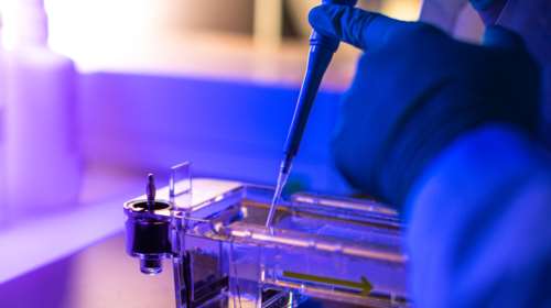 Ευλογιά των πιθήκων: Τα κρούσματα μπορεί να γίνουν χιλιάδες - Καμπανάκι από τους ειδικούς