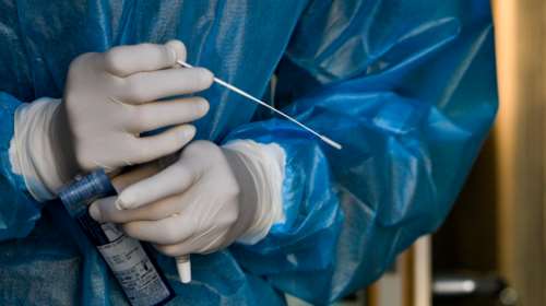 Κορονοϊός: Ποιοι δικαιούνται να κάνουν το τεστ δωρεάν