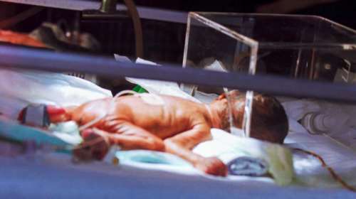 Οξεία ηπατίτιδα: Συναγερμός στον ΕΟΔΥ για τρία πιθανά κρούσματα σε παιδιά στην Ελλάδα - Τα συμπτώματά τους