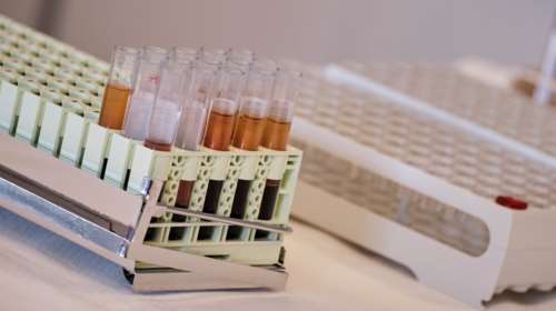 Κορονοϊός: Να αυξηθεί η παγκόσμια παραγωγή δεξαμεθαζόνης ζητά ο ΠΟΥ