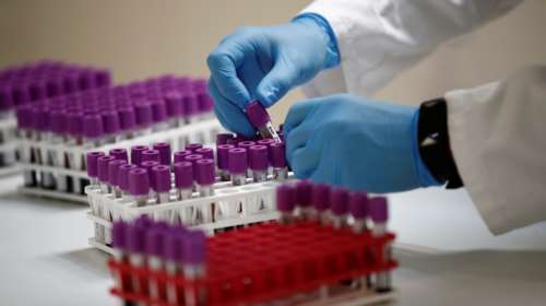 Κοντοζαμάνης: Τις 11.000 θα φθάσει η εγχώρια παραγωγή τεστ κορονοϊού την ημέρα