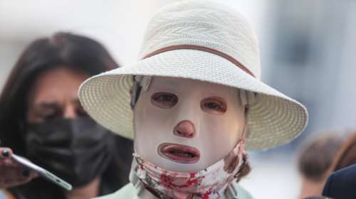 Επίθεση με βιτριόλι: Συγκινημένη η Ιωάννα με τα δύο κακοποιημένα κορίτσια στη Θεσσαλονίκη - Επικοινώνησε μαζί τους [Βίντεο]