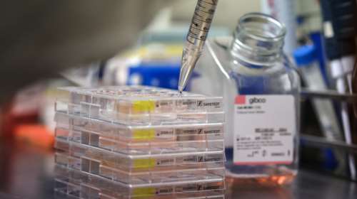 Κορονοϊός - Ανησυχητική εξέλιξη: Μια μετάλλαξη του ιού ξεφεύγει από τα αντισώματα