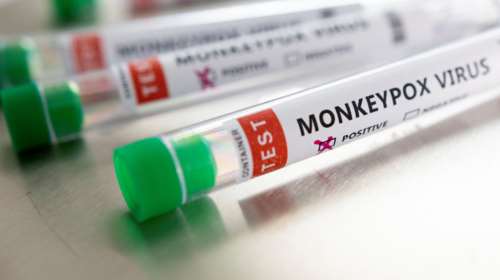 Ευλογιά των πιθήκων: Δεν υπάρχουν αποδείξεις ότι ο ιός έχει μεταλλαχθεί - Οι οδηγίες του ECDC για τα κρούσματα