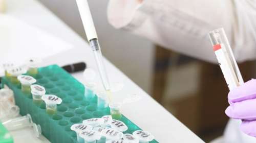 Τουρίστας από τη Βρετανία στο &quot;Αττικόν&quot;: Έχει ανεμοβλογιά - Όχι ευλογιά των πιθήκων