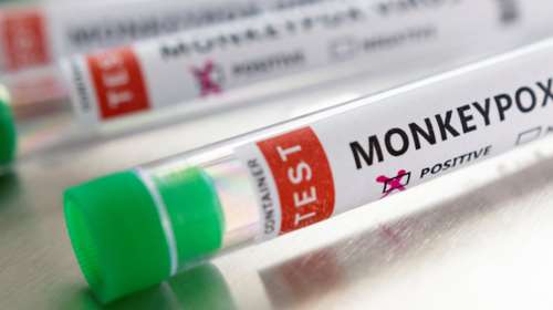 Ευλογιά των πιθήκων: Ανησυχία μετά την ένδειξη για πρώτο κρούσμα εγχώριας μετάδοσης - Συνολικά 7 οι μολύνσεις