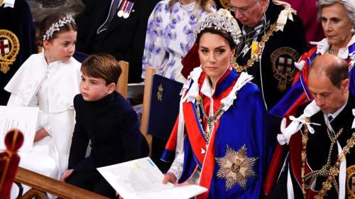 &quot;Στημένη&quot; η φωτογράφιση της Κέιτ μετά το χειρουργείο: Οι λεπτομέρειες που την πρόδωσαν και οι τρεις ρόδες του αυτοκινήτου