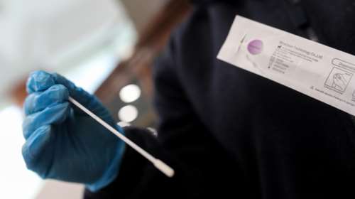 ΕΟΔΥ: Τα 44 σημεία για δωρεάν rapid test σήμερα, Σάββατο