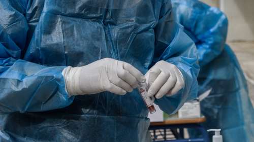 Ευλογιά των πιθήκων: Πρώτο κρούσμα στην Ελλάδα - Άνδρας που ταξίδεψε στην Πορτογαλία