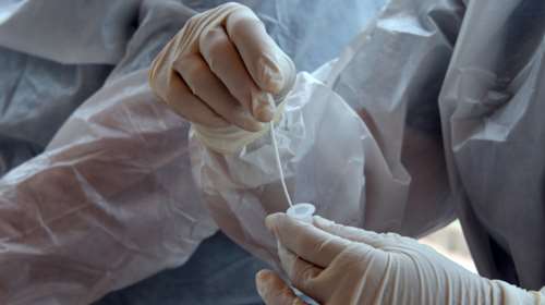 Κορονοϊός: Κυριαρχεί η βρετανική μετάλλαξη στη χώρα σε ποσοστό 66,69%