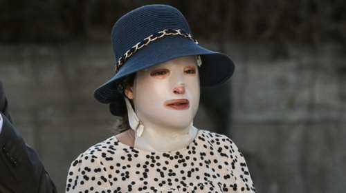 Επίθεση με βιτριόλι: Εμφανίστηκε στο δικαστήριο ο 40χρονος άνδρας με τον οποίο είχε εμμονή η Εφη