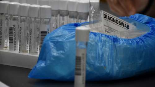 Reuters: Κοντά σε φθηνό μοριακό τεστ για τον κορονοϊό Έλληνες ερευνητές