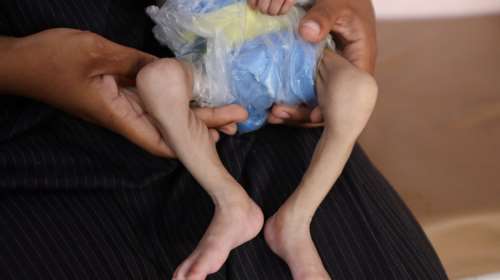 Έκκληση για την Γάζα: &quot;Λιμός μπροστά στα μάτια μας&quot; - Κοινή δήλωση ΕΕ, Βρετανίας, Ιαπωνίας, Καναδά και Αυστραλίας