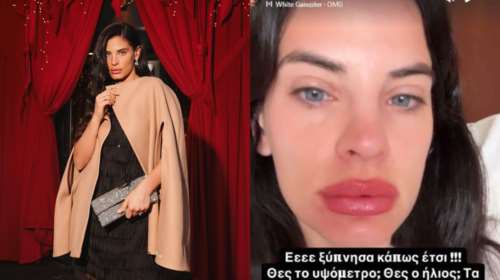 Χριστίνα Μπόμπα: Πήγε στη Βολιβία και πρήστηκαν τα χείλη της - &quot;Ξύπνησα κάπως έτσι...&quot; [βίντεο]