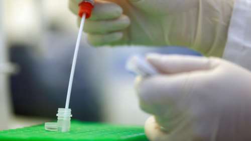 Κορονοϊός: Ερχονται τα &quot;πιστοποιητικά ανοσίας&quot; - Τι είναι και ποιες χώρες τα σχεδιάζουν