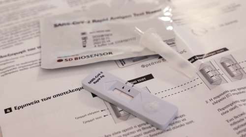 Γεωργιάδης: Ποιος θα πληρώνει το κόστος των self test σε λιανεμπόριο και εστίαση