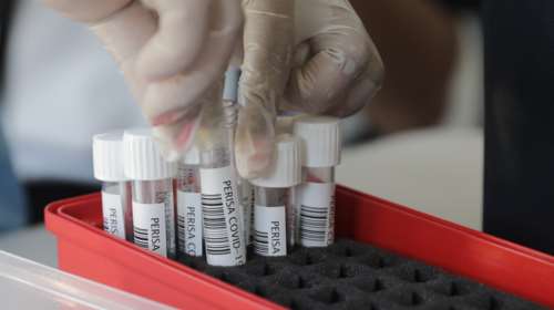 Aπροτινίνη: Φάρμακο κατά του κορονοϊού από Γερμανούς και Βρετανούς - Μπλοκάρει την είσοδο του ιού στα κύτταρα