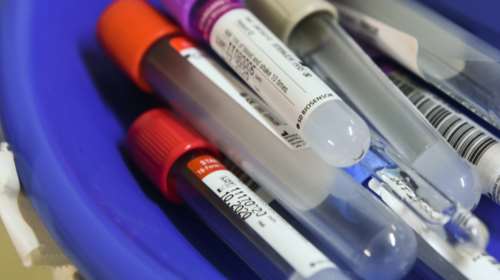 Κοροναϊός: Αρνητικό το δείγμα του στρατιώτη στη Ρόδο - Αρνητικά και άλλα 153 γύρω από τους 4 ασθενείς