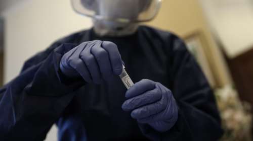 Τσιόδρας: Αυτό είναι το αξιόπιστο τεστ αυτήν τη στιγμή - Ποιο δίνει ασφαλή αποτελέσματα