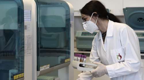 Έρευνα ανατρέπει ό,τι ξέραμε για τον κορονοϊό: Η νόσος Covid-19 είναι αγγειακή και όχι αναπνευστική