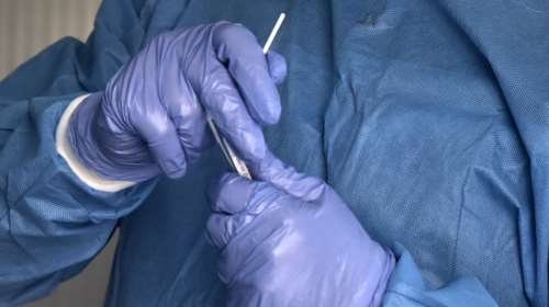 Σαρώνει ο στρεπτόκοκκος: 94 κρούσματα και 23 θανάτους κατέγραψε ο ΕΟΔΥ σε ένα χρόνο - 11 παιδιά έχασαν τη ζωή τους