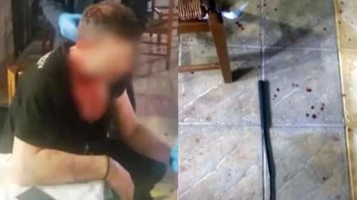 Αγρίνιο: Δεν τους άρεσε το φαγητό και χτύπησαν με σιδερένιο γκλοπ τον εστιάτορα στο κεφάλι - Λύγισε το αντικείμενο [βίντεο]