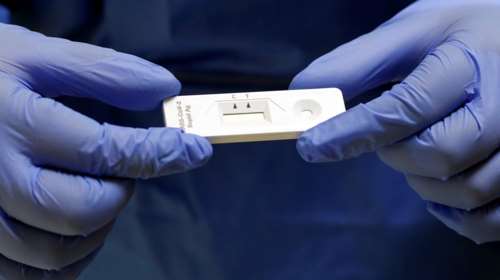 Κορονοϊός: Με πόσα αντισώματα είμαστε ασφαλείς απέναντι στον θανατηφόρο ιό [βίντεο]