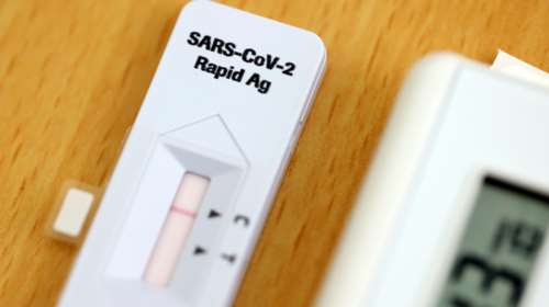 Κορονοϊός - ΗΠΑ: Εγκρίθηκε τεστ της Roche που υπολογίζει το επίπεδο αντισωμάτων - Αποτέλεσμα σε 18 λεπτά