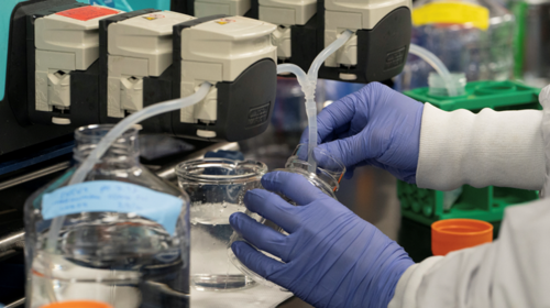 Σύψας για χλωροκίνη: &quot;Δεν είναι τόσο αποτελεσματική, φαίνεται να συνδέεται και με αρρυθμίες στην καρδιά&quot; [Βίντεο]