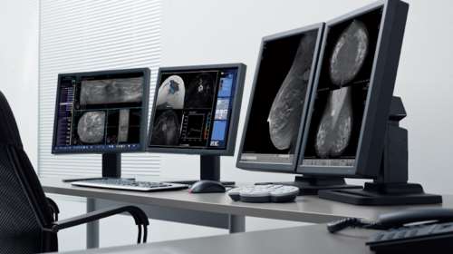 ΙΑΤΡΟΠΟΛΙΣ: Η Τεχνητή Νοημοσύνη και στη μάχη κατά του καρκίνου μαστού