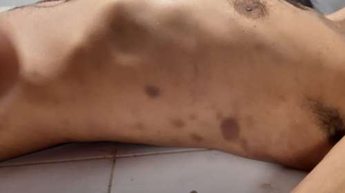 Καταγγελία του ΚΕΕΡΦΑ για νεκρό μετανάστη στο ΑΤ Αγίου Παντελεήμονα- Τι απαντά η ΕΛΑΣ [σκληρές εικόνες]