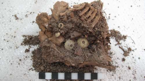 Στην Αίγινα εντοπίστηκε σκελετός μωρού με σύνδρομο Down : Εζησε τον 13ο αιώνα προ Χριστού