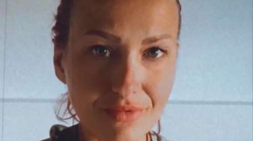 Θεσσαλονίκη: Καλά νέα για την 39χρονη που τη δάγκωσε οχιά - Βγαίνει από τη ΜΕΘ