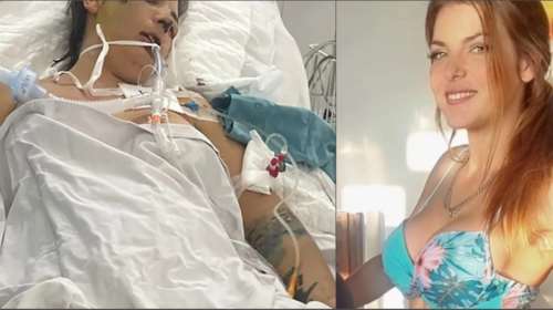 Χαροπαλέυει 31χρονη από την Αυστραλία: Πήγε στο Βιετνάμ για επέμβαση αισθητικής και βρέθηκε στην εντατική