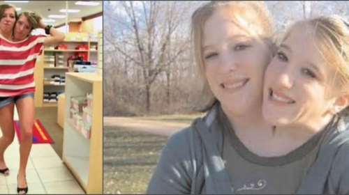 Δύο ζωές σε ένα σώμα: Πώς ζουν και πώς ονειρεύονται να αποκτήσουν παιδιά οι πιο διάσημες σιαμαίες δίδυμες [εικόνες]