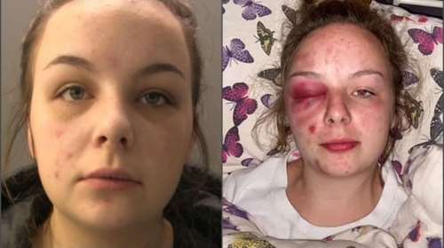 Απίστευτο: Κατά φαντασίαν θύμα βιασμού - Kατηγόρησε ψευδώς τρεις άνδρες φέρνοντάς τους στα πρόθυρα αυτοκτονίας