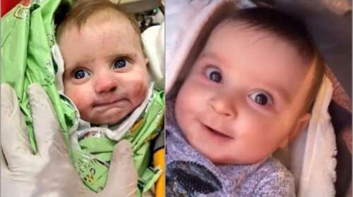 Σεισμός στην Τουρκία: Το χαμόγελο του παιδιού μόλις 2 μηνών, που επέζησε 128 ώρες κάτω από τα ερείπια έγινε viral