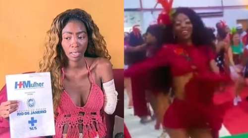 Εφιάλτης για Βραζιλιάνα χορεύτρια: Μπήκε στο νοσοκομείο για αφαίρεση ινομυωμάτων και της ακρωτηρίασαν το χέρι