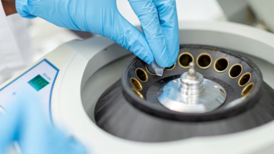 Τι είναι το καρκινογόνο γονίδιο TP53 του δότη σπέρματος - Εχουν γεννηθεί 18 παιδιά σε 11 οικογένειες στην Ελλάδα