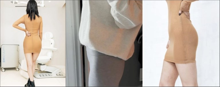 ΠΛΑΣΤΙΚΗ ΧΕΙΡΟΥΡΓΙΚΗ ΛΙΠΟΣ