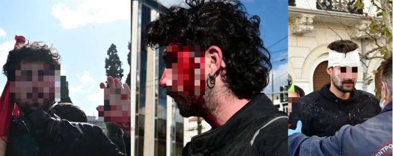 ΤΡΑΥΜΑΤΙΕΣ ΕΠΕΙΣΟΔΙΑ