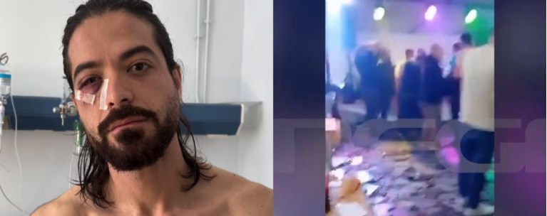 ΑΡΗΣ ΜΟΥΓΚΟΠΕΤΡΟΣ