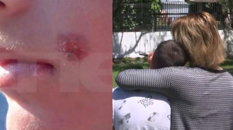 Πέλλα bullying