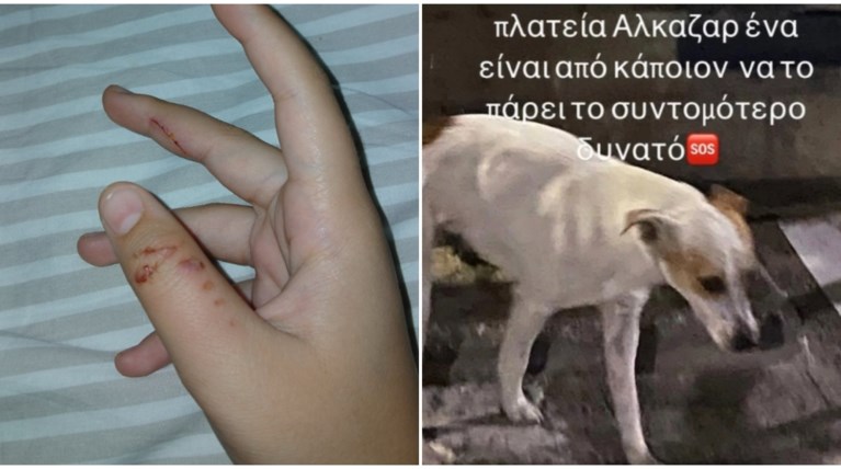 επιθεση σκυλου