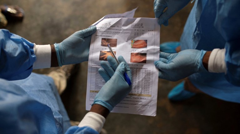 monkeypox